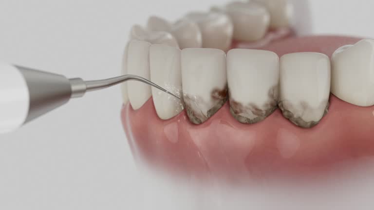 Reliable Dental contractor in Hamtramck, MI by Smile Center Dentistry